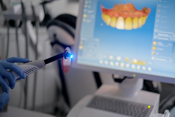 How CEREC Is Used For Dental Restorations