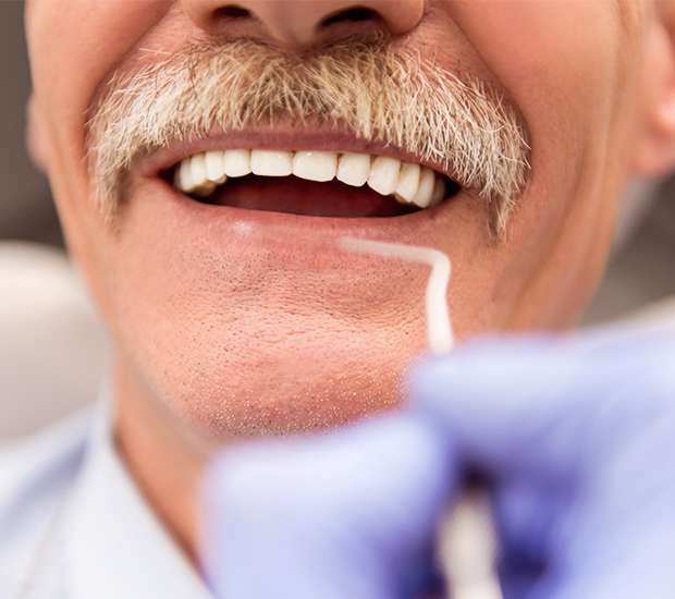 The Colony Adjusting to New Dentures