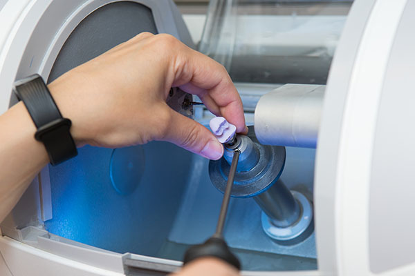 Benefits Of CEREC &#    ; Computer Aided Design And Manufacturing