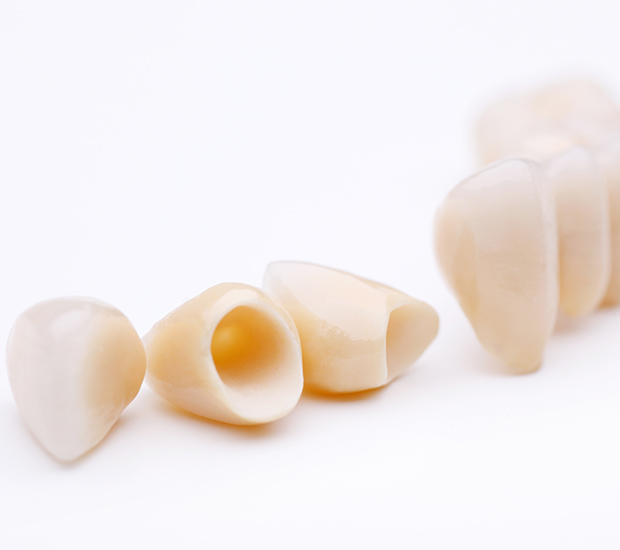 The Colony Dental Crowns and Dental Bridges
