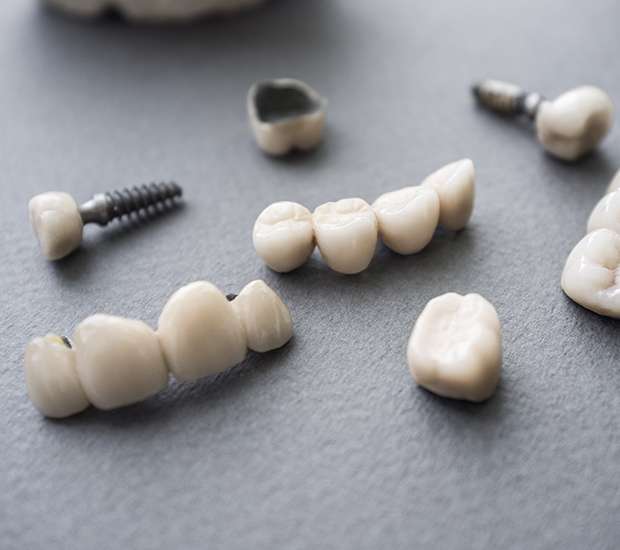 The Colony The Difference Between Dental Implants and Mini Dental Implants