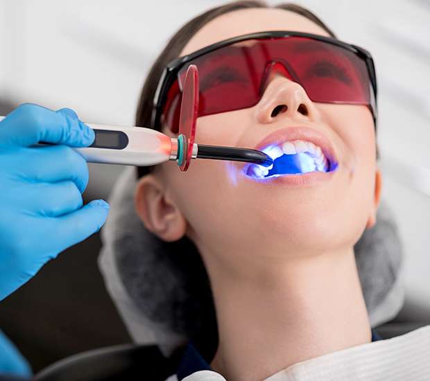 The Colony Professional Teeth Whitening